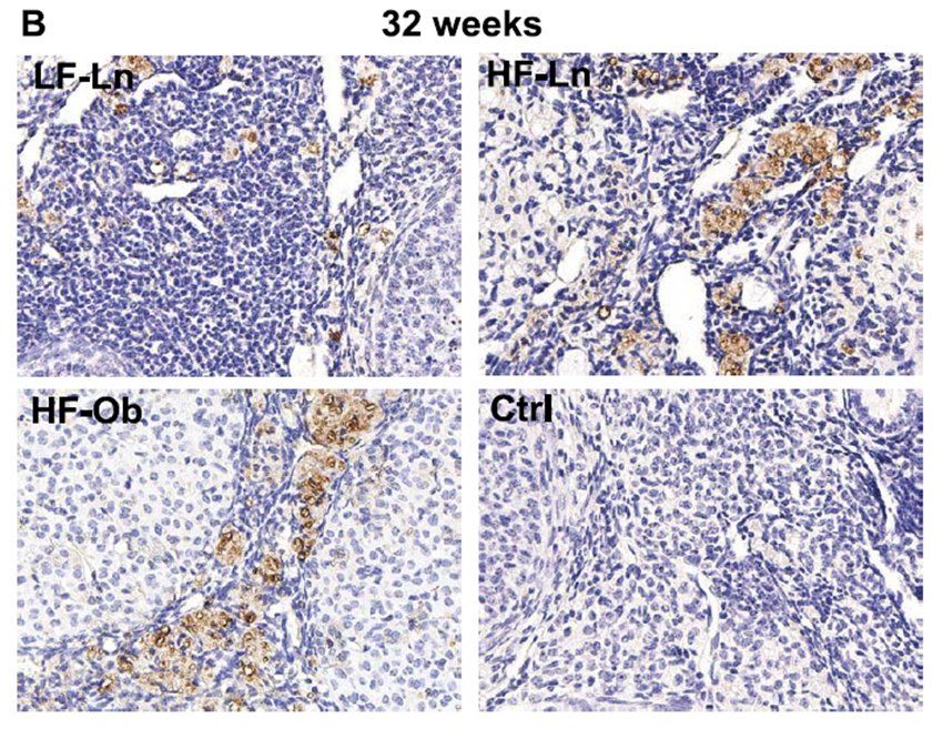 CD68 antibody