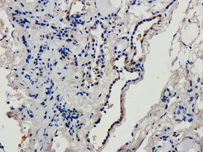 CD69 antibody