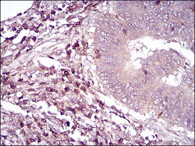 CD6 Antibody