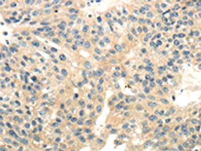 CD70 Antibody