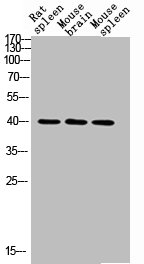 CD72 antibody