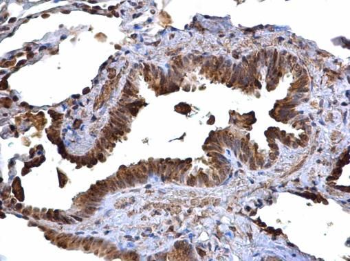 CD74 antibody [N1N2], N-term