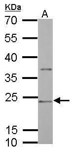 CD74 antibody [N1N2], N-term
