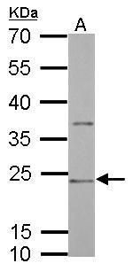 CD74 antibody