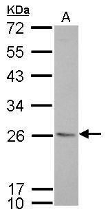 CD74 antibody [N1N2], N-term