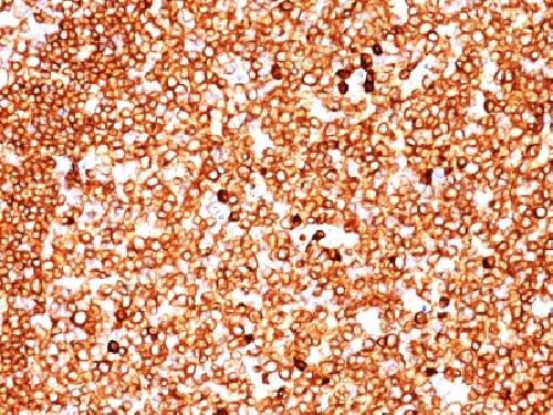 CD79A Antibody