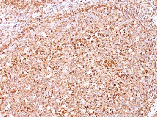 CD79A Antibody