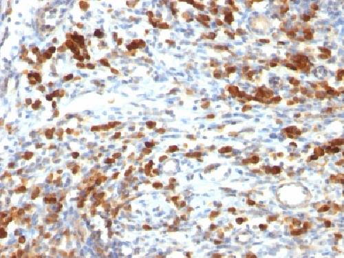 CD79A Antibody
