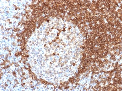 CD79A Antibody