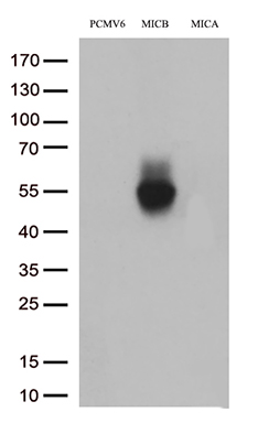 CD79B Antibody