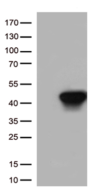 CD79B Antibody
