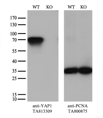 CD79B Antibody