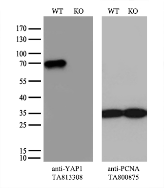 CD79B Antibody