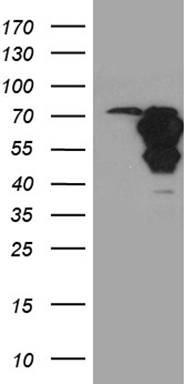 CD79B Antibody