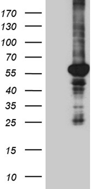 CD79B Antibody
