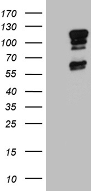 CD79B Antibody