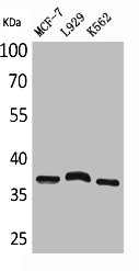CD79B Antibody