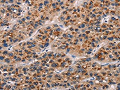CD80 Antibody