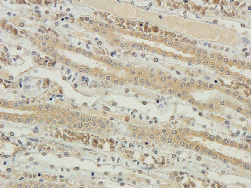 CD81 antibody