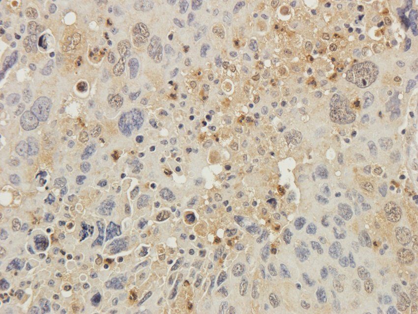 CD81 antibody