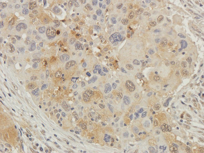 CD81 antibody