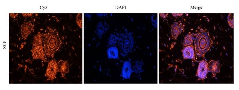 CD81 antibody