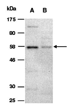 CD86 (N) Antibody, Rabbit Polyclonal