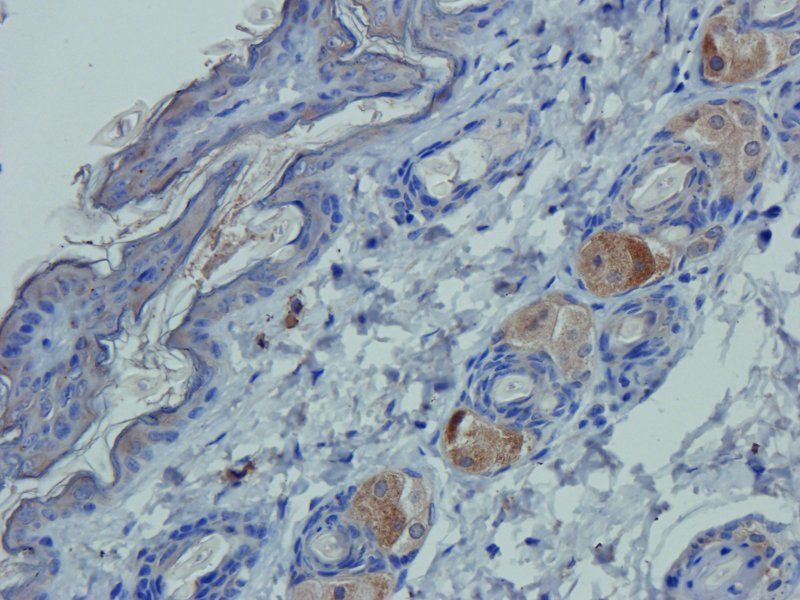 CD8 antibody