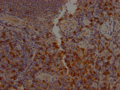 CD8A Recombinant Monoclonal Antibody