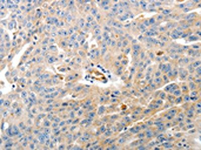 CD93 antibody