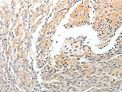 CD93 Antibody