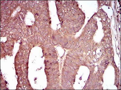 CD93 Antibody