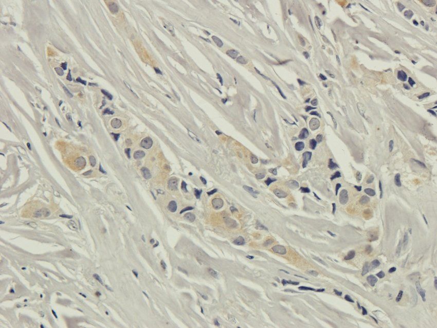 CD95 antibody