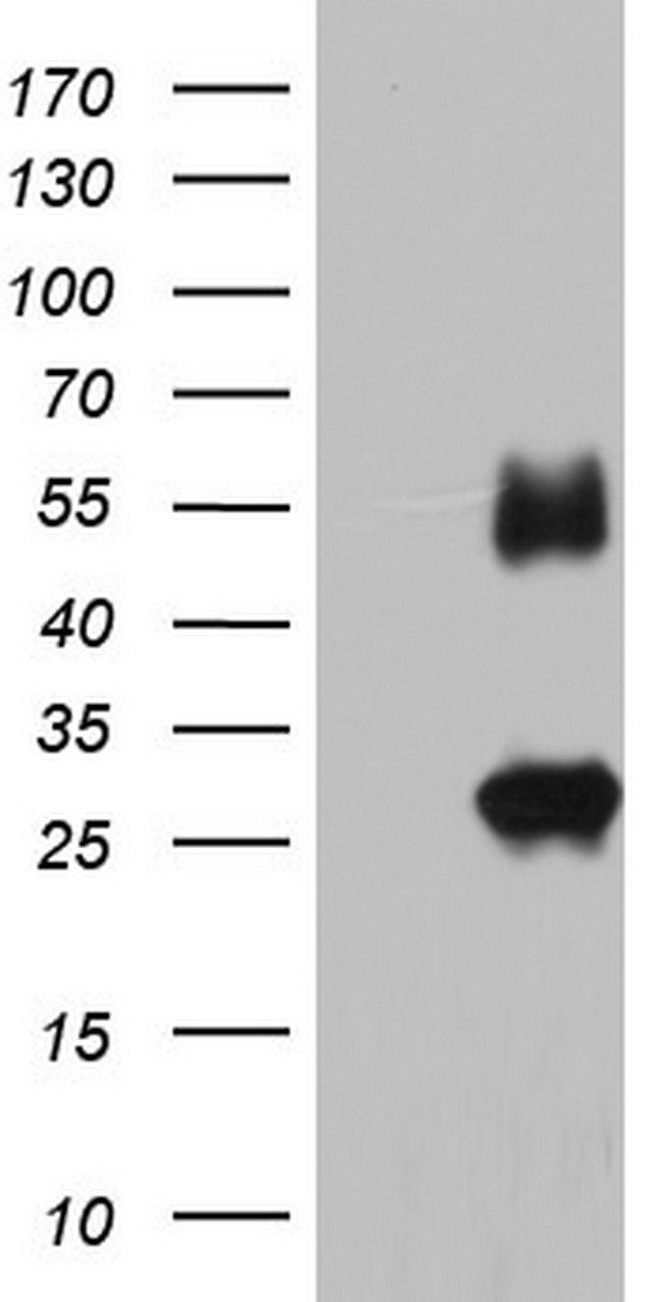CD99 Antibody