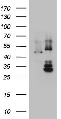 CD99 Antibody