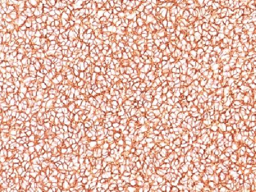 CD99 / MIC2 (Ewing's Sarcoma Marker) Antibody