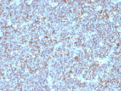 CD99 / MIC2 (Ewing's Sarcoma Marker) Antibody