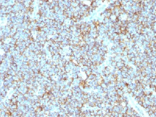 Recombinant CD99 / MIC2 (Ewing's Sarcoma Marker) Antibody