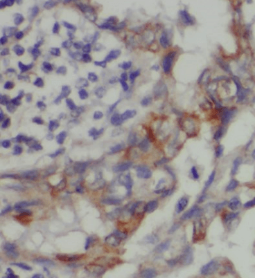 CDA1 antibody