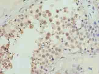CDADC1 Antibody