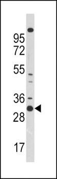 CDC2 antibody
