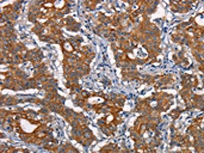 CDC23 Antibody