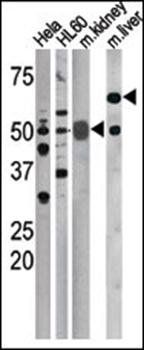 CDC25A (phospho-Ser75) antibody