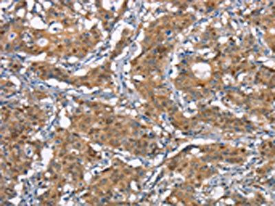 CDC25A Antibody