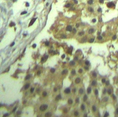 CDC2 Rabbit Polyclonal Antibody