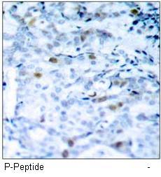 CDC2 (Phospho-Thr161) Antibody