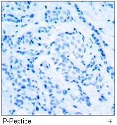 CDC2 (Phospho-Thr161) Antibody