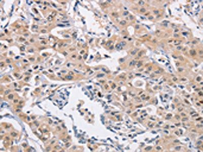 CDC34 Antibody