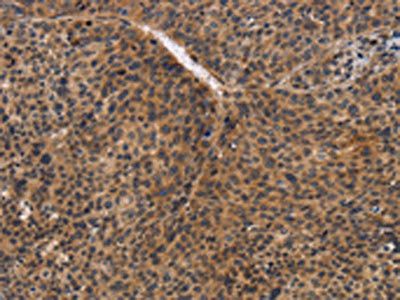 CDC34 Antibody