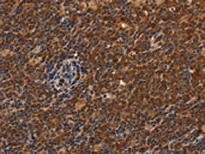 CDC34 Antibody
